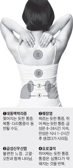 등에 나타나는 통증은 단순 근육통이 아닌 몸 속 장기에 문제가 생겼을 때 나타나기도 한다. 사진-헬스조선DB
