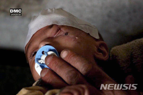 【다마스쿠스미디어센터·AP/뉴시스】시리아 수도 다마스쿠스 인근 동구타에서 카림이란 생후 2개월된 아기가 폭탄으로 한 눈을 잃은 모습. 사진은 다마스쿠스 미디어 센터가 제공한 것이다. 온라인상에서는 카림처럼 한 쪽 눈을 가리고 사진을 찍어 올리는 캠페인이 진행 중이다. 2017.12.20