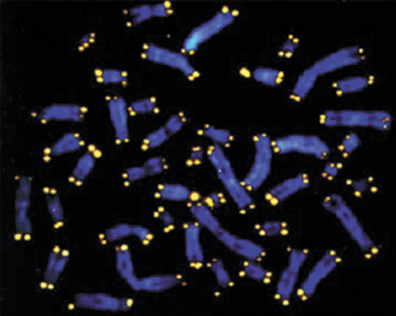세포의 염색체 끝의 형광색 부분이 텔로미어다. 텔로미어 길이가 길수록 노화 속도가 늦다. [중앙포토]