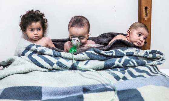 2018년 2월 26일 시리아 동구타 지역에 가해진 정부군의 화학공격으로 피해를 입은 어린이들이 치료를 받고 있다. BBC는 시리아 난민들이 자국으로 돌아가기 두려워하는 이유 중 1순위로 자녀에 대한 안전 위협을 꼽았다.[EPA=연합뉴스]