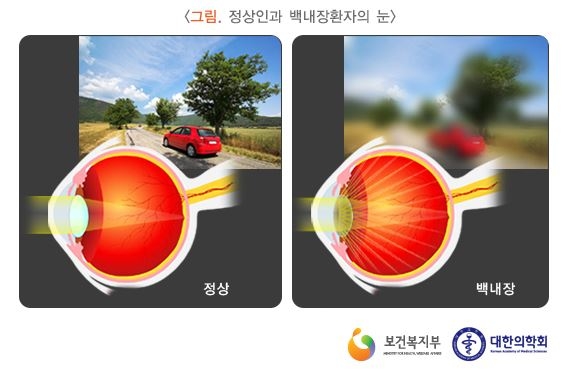 수인건강 이미지
