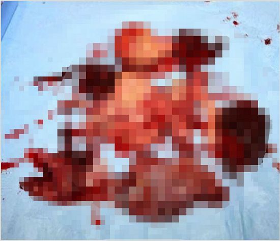 13일 저녁 워마드 게시판에 낙태한 태아사진이 올라왔다. (사진=워마드 게시판 캡처)