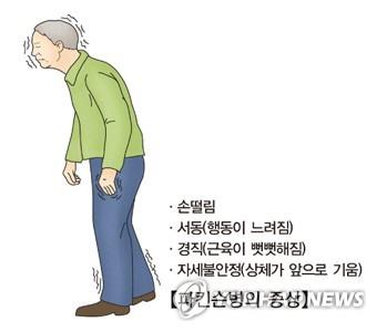 파킨슨병 증상 [서울아산병원 제공]