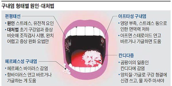 /그래픽=이지혜