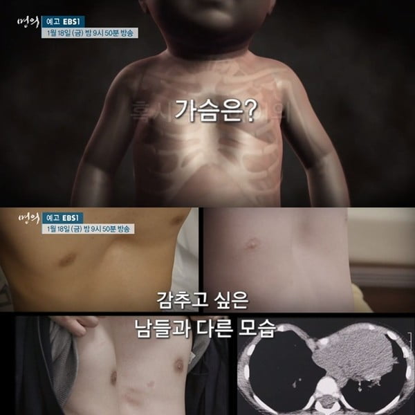 오목이네 이미지