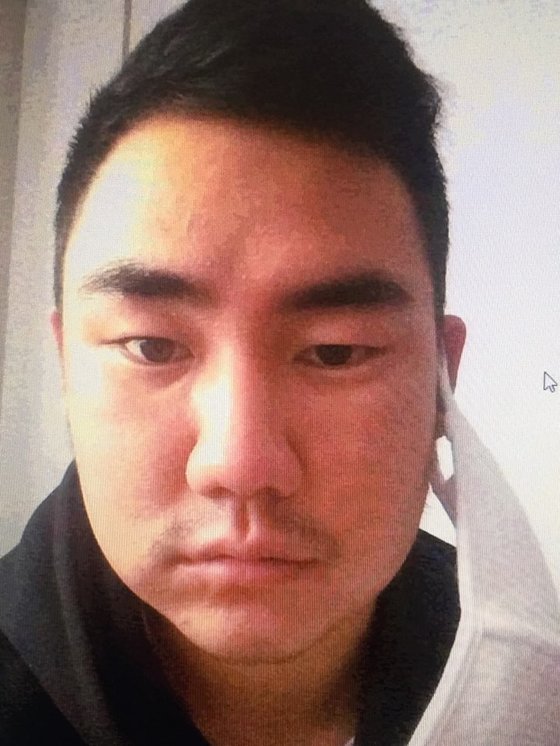 지난 2015년 5월 이택근에게 방망이로 머리를 맞고 얼굴이 부어있는 문우람의 모습. [사진 문우람]