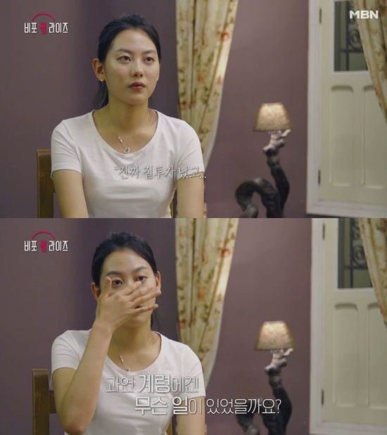 비포 이미지