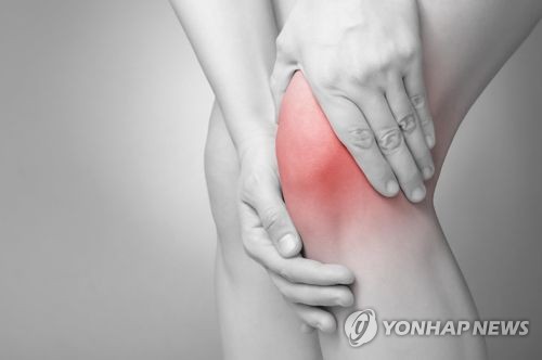 관절염 [게티이미지뱅크 제공]