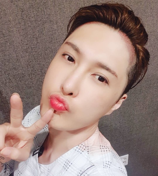 장헤어라인 이미지