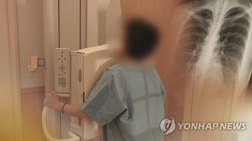 폐암 검진(CG) [연합뉴스TV 제공]