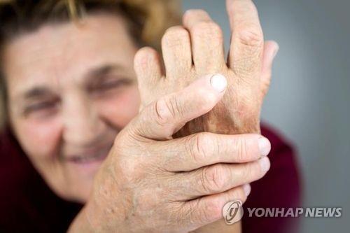 관절염 [연합뉴스 자료사진]