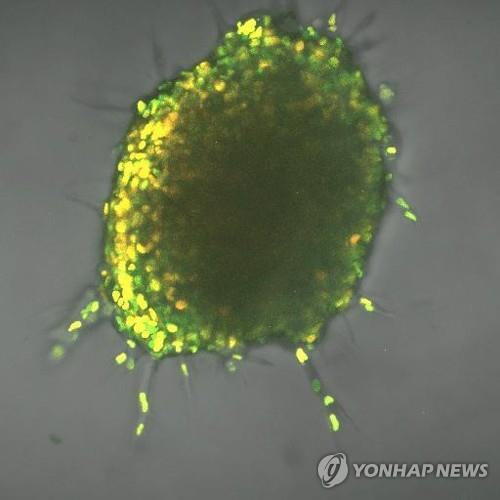 형광 바이오센서로 추적한 암세포 종양. 밝은 부위가 고에너지 소비 세포. [밴더빌트대 라인하르트-킹 실험실 제공]