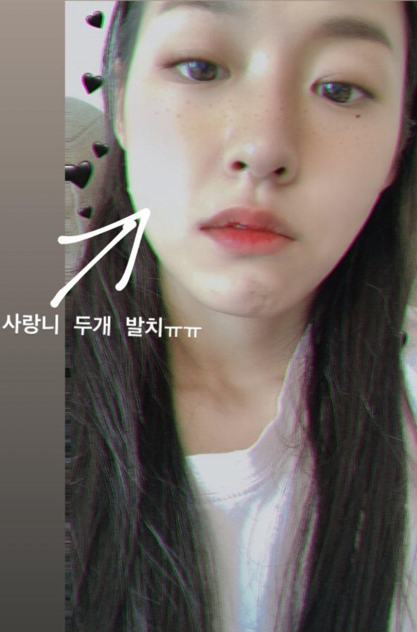 Group AOA Seolhyun has released a shot of wisdom teeth extraction.Seolhyun posted several photos on his instagram story on the 24th, along with an article entitled Two love teeth, I feel strange to see because I do not have anesthesia.The photo shows Seolhyun, who has a slightly swollen ball after picking out his wisdom teeth, and his beautiful appearance is still eye-catching even in his comfortable clothes and light makeup.He received fans questions and advice about wisdom teeth and said, It was so anesthetic and sore. Before I picked it, I thought I wanted to pick it quickly, but it hurts more.I think it is more painful to pick up my upper and lower teeth at the same time. Meanwhile, AOA reorganized into a five-member group of Seolhyun Jimin Yuna Hye-jungs praise regime after Mina withdrew; the comeback schedule is not yet known.PhotoSeolhyun SNS