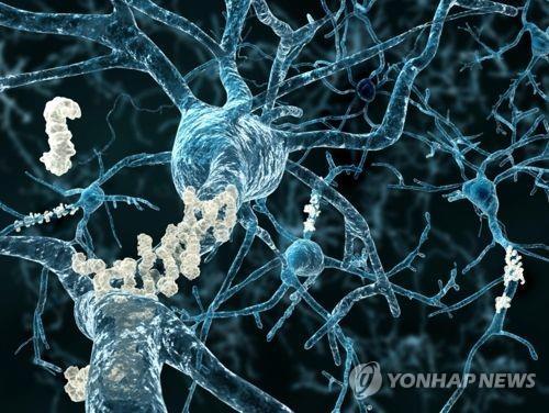 뇌 신경에 침적한 베타 아밀로이드 플라크  [연합뉴스 자료사진]
