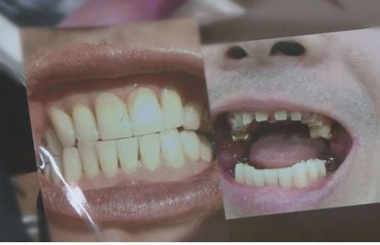 김치과의원 이미지