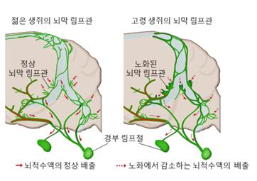 노화에 따라 뇌막 림프관이 비대해짐을 나타낸 그림 [과학기술정보통신부 제공]