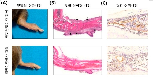 태반형성인자를 정상적으로 만드는 생쥐 (그림 A의 윗부분)에 비해 태반성장인자가 부족한 생쥐(그림 A의 아랫부분)에서 뒷다리 관절의 붓기가 현저히 줄어들었음을 관찰할 수 있다./자료=가톨릭대학교