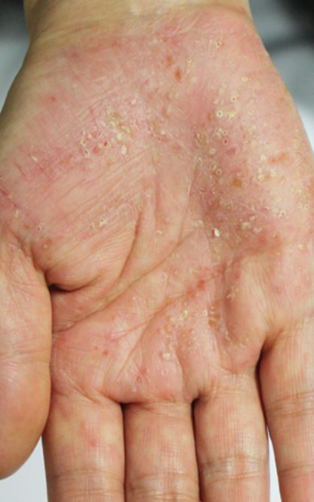 자주고름 이미지