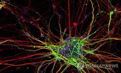 정상보다 빠르게 자라는 자폐증 환자의 뇌 신경세포 [미 소크연구소 제공]