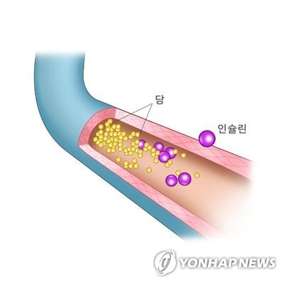 당뇨병 설명도 [삼성서울병원 제공]