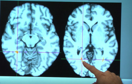 뇌 스캔 검사 이미지.