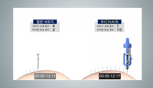 일반 식모기(왼쪽)와 연발형 식모기(오른쪽) 비교