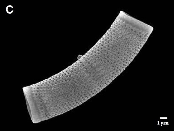 낙동강에서 채집된 규조류(돌말) 아울라코세리아(Aulacoseria ambigua)의 전자현미경 사진. [국립낙동강생물자원관]