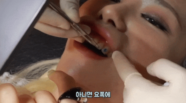 '투스 젬' 부착 과정 [유튜버 '꽁지' 제공, 제작 남궁선. 재판매 및 DB 금지]