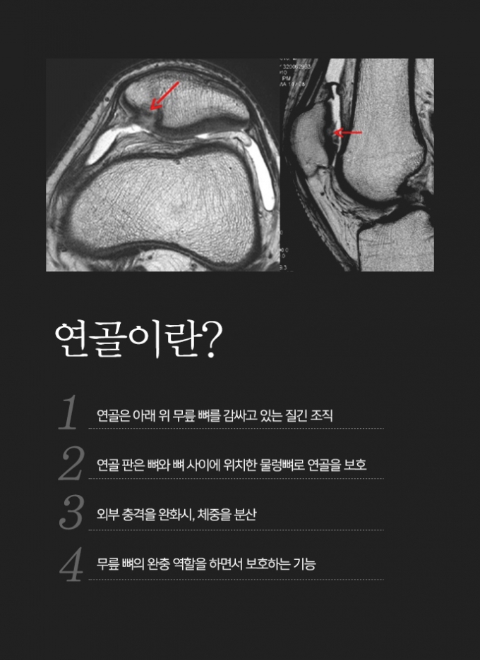 건우 이미지