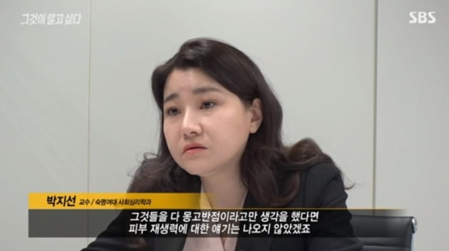 몽고반점 이미지
