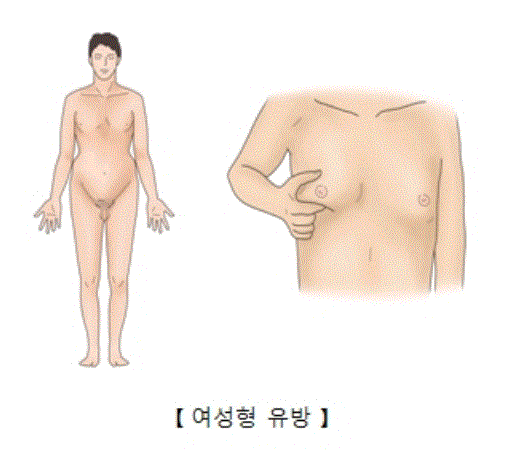 출처: 서울아산병원