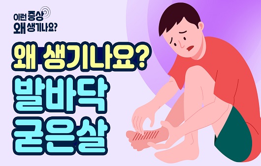 발에 굳은살이 잘 생겨요