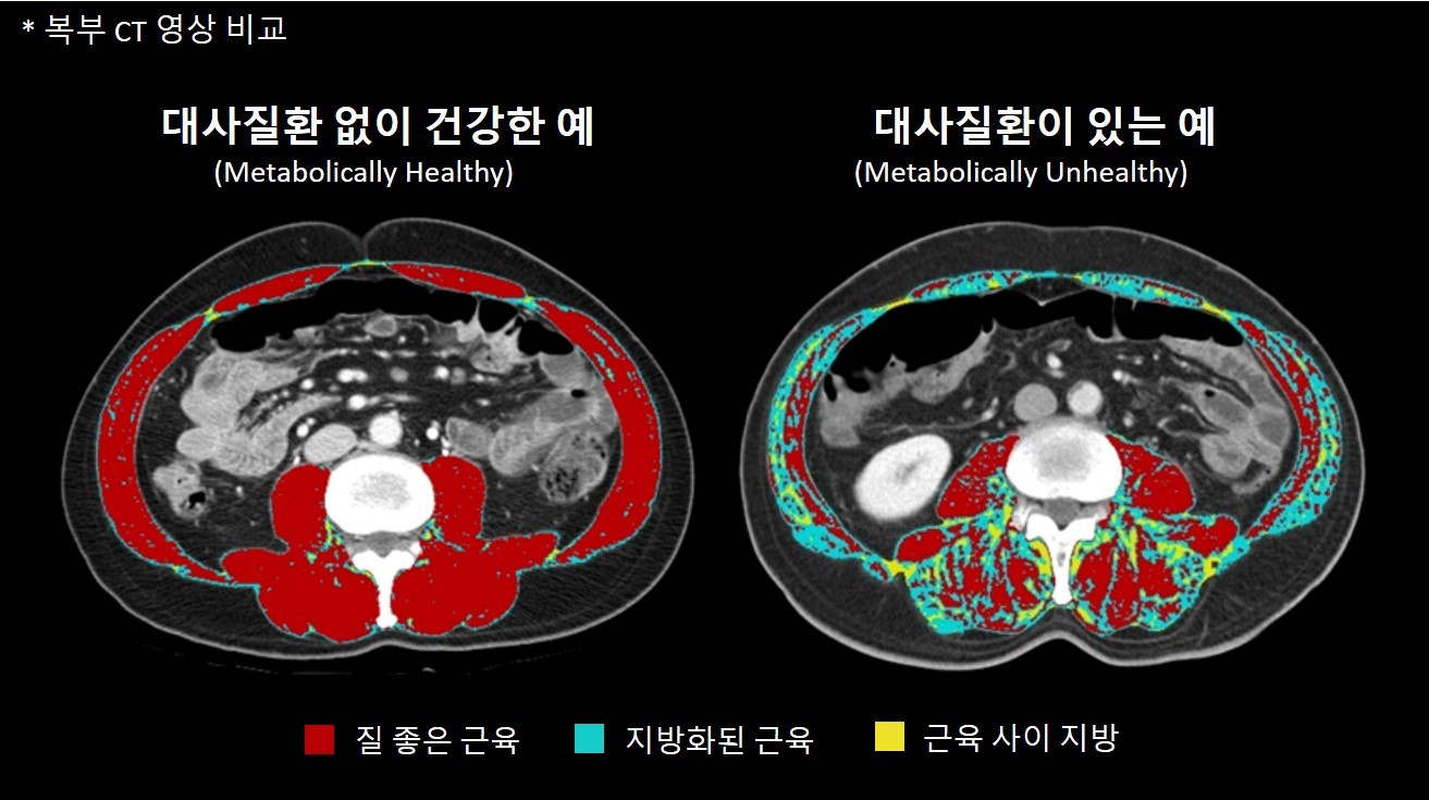 근육풀이 이미지