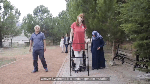 세계에서 가장 키가 큰 여성으로 기네스북에 등재된 터키 여성 루메이사 겔기가 보조기구를 이용해 산책을 하고 있다. /영상=기네스북