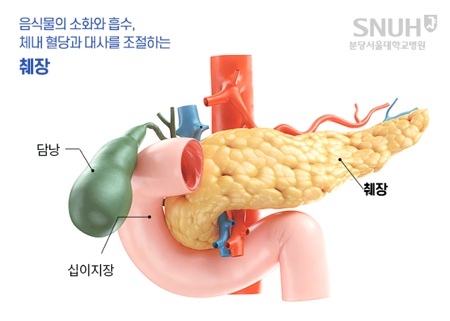 췌장암의 다양한 치료와 예후 [분당서울대병원이 알려주는 의료상식]