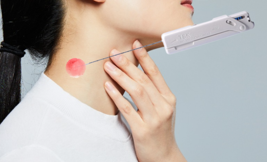 목 옆에 만져지는 혹, 멍울의 진실 | 남녀생활백서 목 옆에 만져지는 혹, 멍울의 진실 | 남녀생활백서