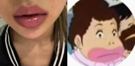 이브 이미지