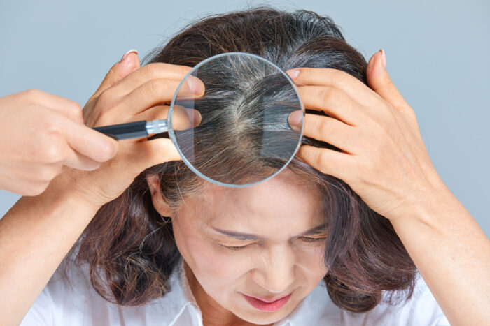 처짐의 원인을 조사하십시오. 모발 영양 도움 Blasea