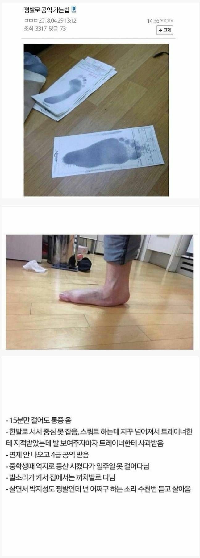 평발을 인증했던 사람의 레전드 사연 | 인스티즈