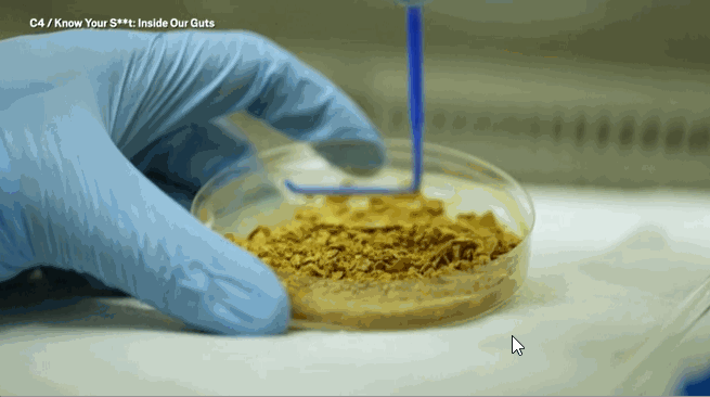 [서울=뉴시스] 영국 방송 채널 '채널4'는 자사 특집 프로그램인 '노우 유어 시트'에서 '대변 알약'의 제조 과정을 담아냈다 (사진출처: 메트로 영상 캡처) 2023.01.18. *재판매 및 DB 금지