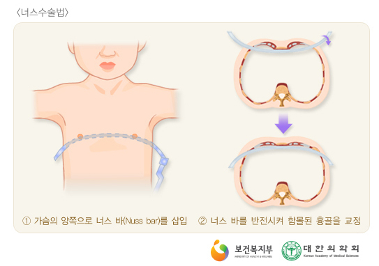 오목이네 이미지