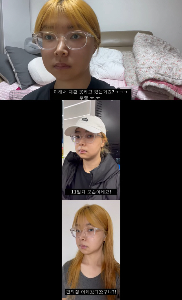 영자머리 이미지