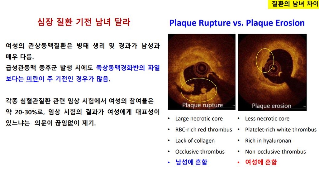 금성헬스 이미지