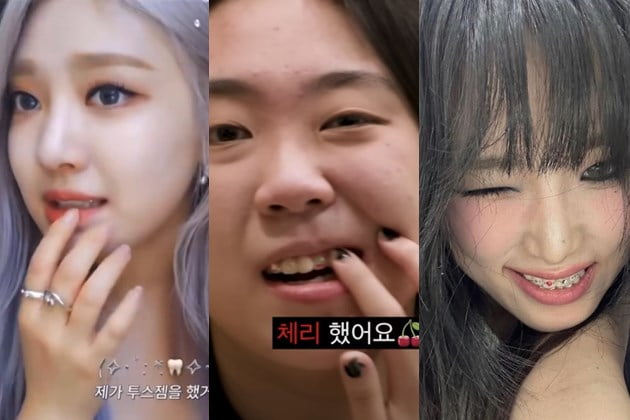 투스 이미지