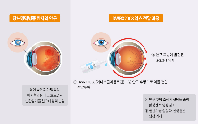 대웅 이미지