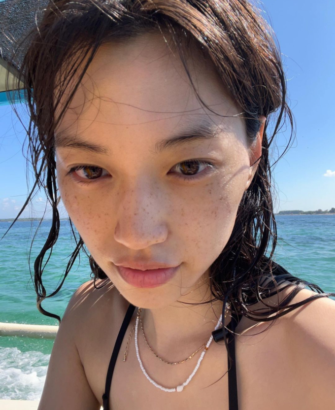 김도연피부 이미지