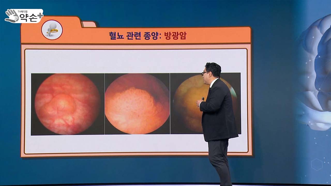 건강약손 이미지