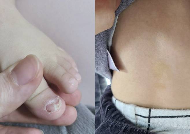 아름 이미지