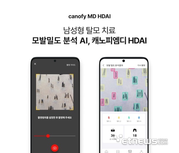 밀도 이미지