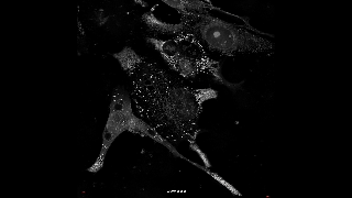 핵막이 폭발적으로 파열해 세포 사멸이 이뤄지는 캐리옵토시스 과정을 국내 연구팀이 최초로 영상에 담았다. 조용연 교수 제공